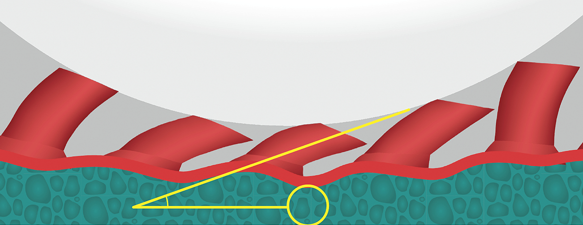 AbsorberSponge Drop: Pimples AbsorberSponge Drop: Pimples